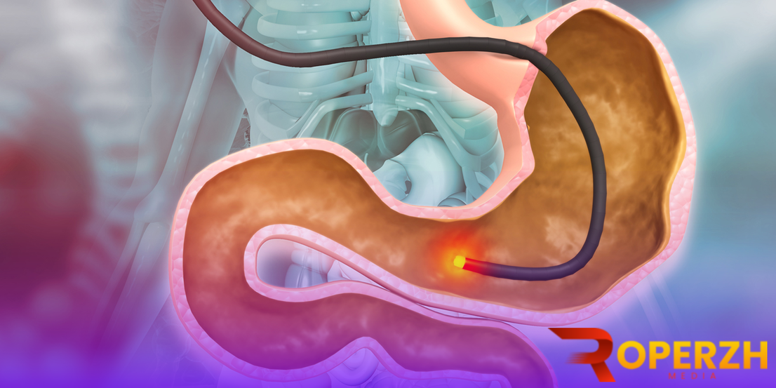 Mengenal Perkembangan Teknologi Endoskopi 13 endoskopi